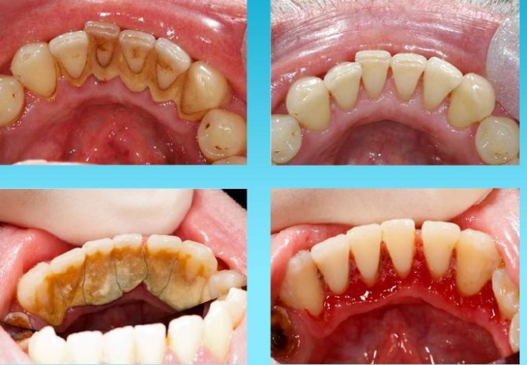 Hygienist Cleadon Village Dental PracticeCleadon Village Dental Practice